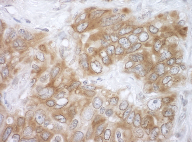 VAPB Antibody in Immunohistochemistry (IHC)