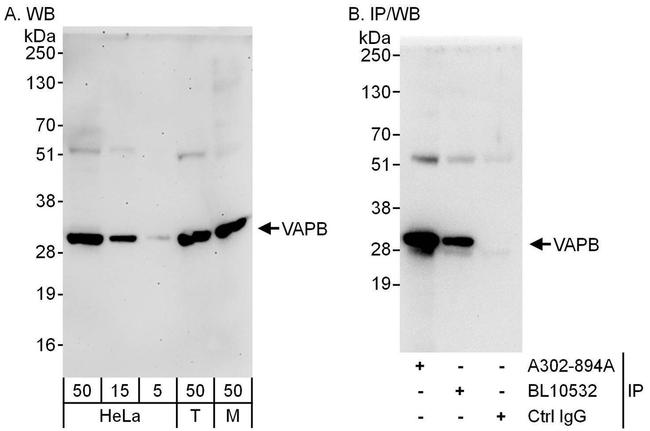 VAPB Antibody in Western Blot (WB)