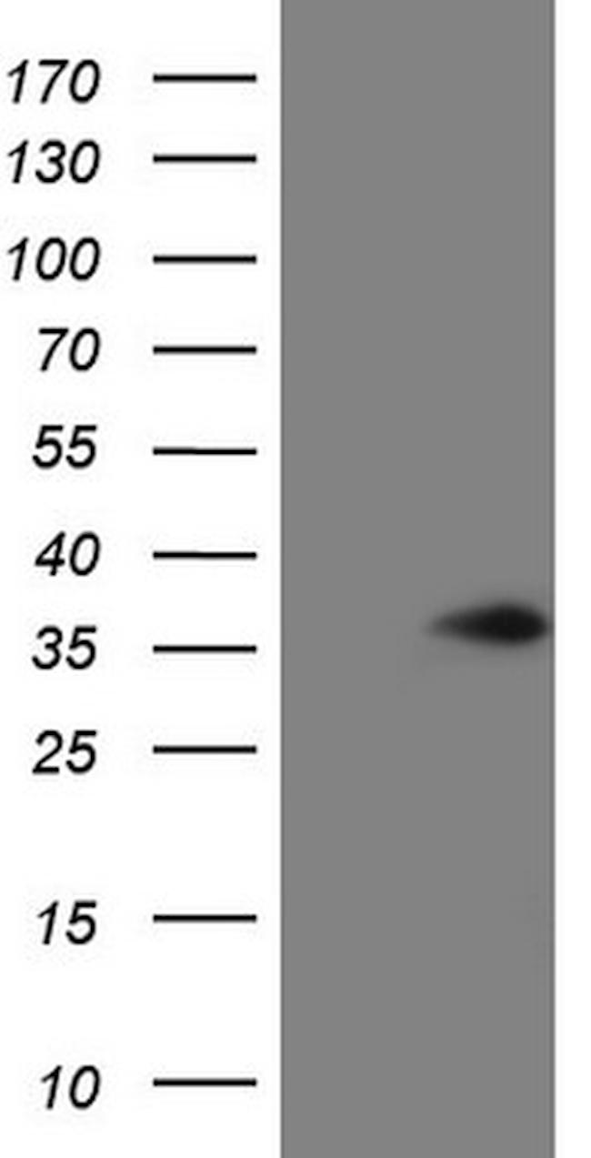 VAPB Antibody in Western Blot (WB)