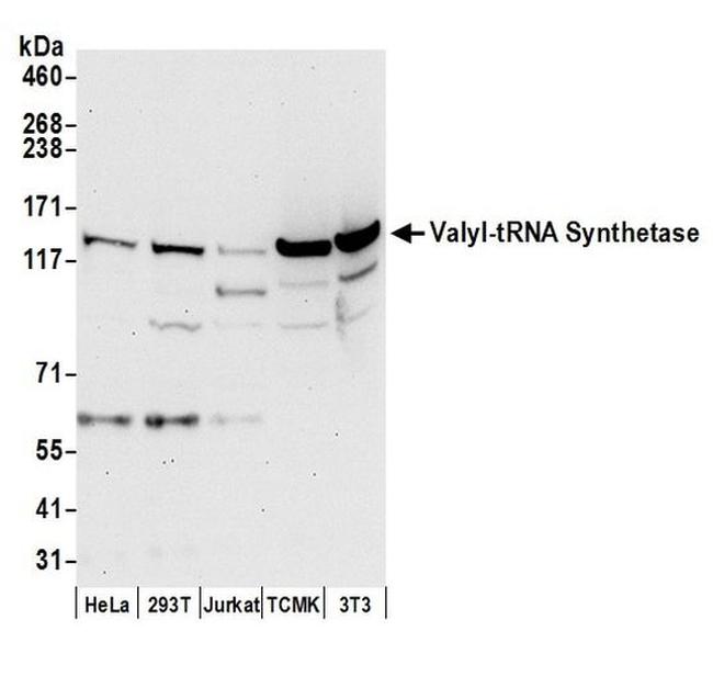 Valyl-tRNA Synthetase/VARS Antibody in Western Blot (WB)