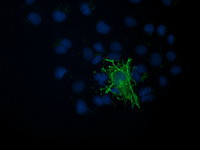 VASP Antibody in Immunocytochemistry (ICC/IF)