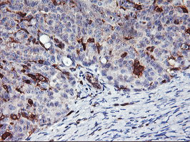 VASP Antibody in Immunohistochemistry (Paraffin) (IHC (P))