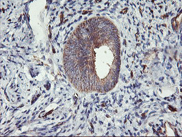 VASP Antibody in Immunohistochemistry (Paraffin) (IHC (P))