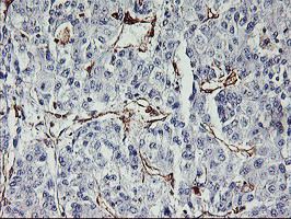 VASP Antibody in Immunohistochemistry (Paraffin) (IHC (P))