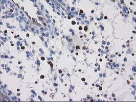 VASP Antibody in Immunohistochemistry (Paraffin) (IHC (P))