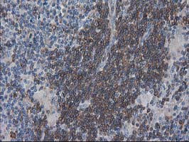 VASP Antibody in Immunohistochemistry (Paraffin) (IHC (P))