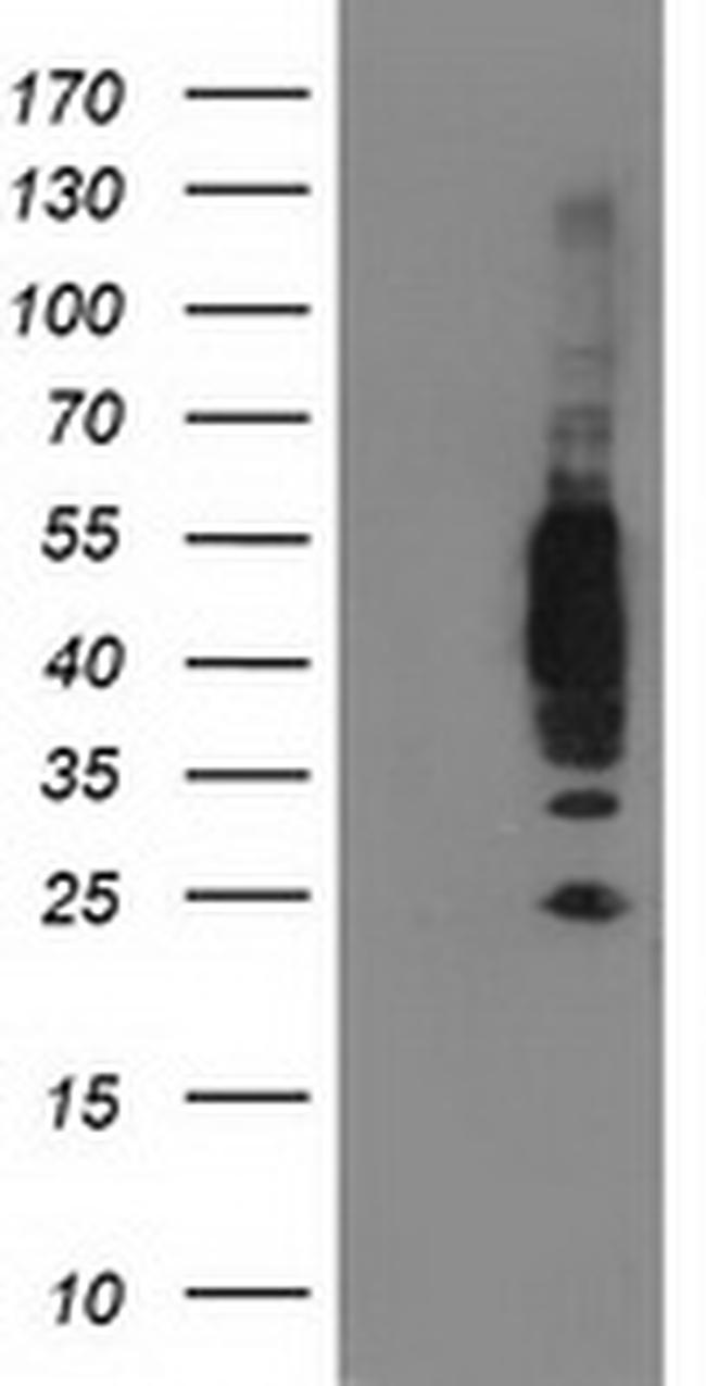 VASP Antibody in Western Blot (WB)