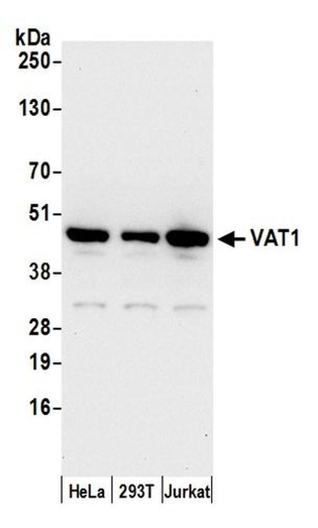 VAT1 Antibody in Western Blot (WB)