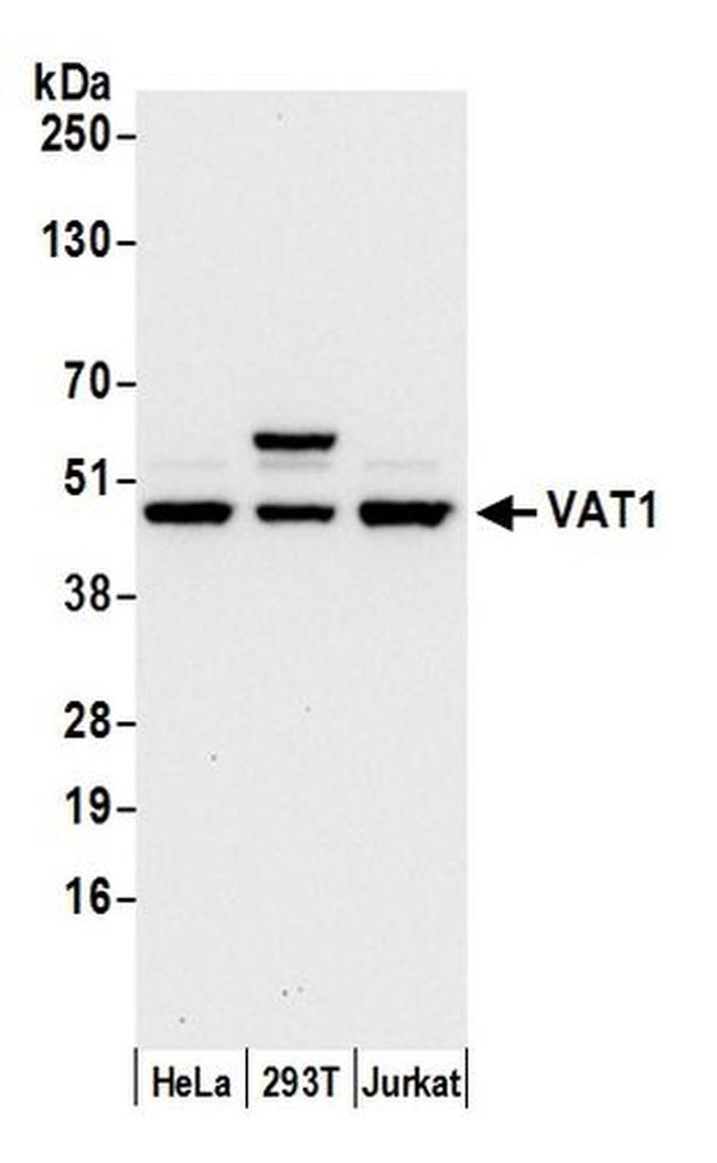 VAT1 Antibody in Western Blot (WB)