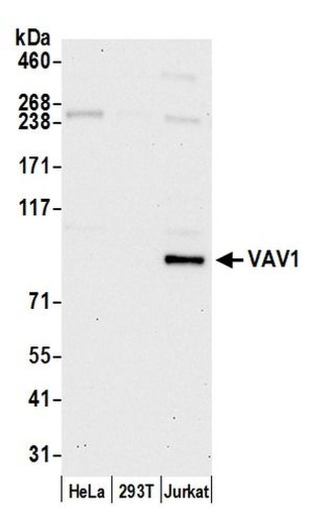 VAV1 Antibody in Western Blot (WB)