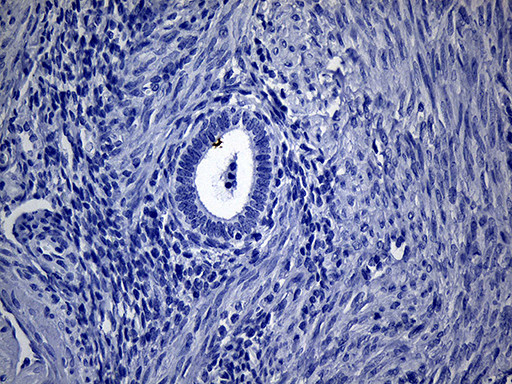 VAX1 Antibody in Immunohistochemistry (Paraffin) (IHC (P))