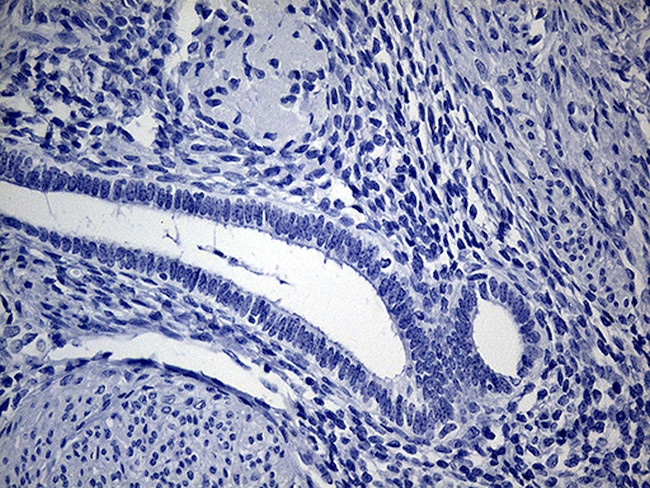 VAX1 Antibody in Immunohistochemistry (Paraffin) (IHC (P))