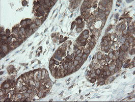 VBP1 Antibody in Immunohistochemistry (Paraffin) (IHC (P))