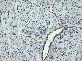 VBP1 Antibody in Immunohistochemistry (Paraffin) (IHC (P))