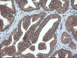 VBP1 Antibody in Immunohistochemistry (Paraffin) (IHC (P))