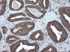 VBP1 Antibody in Immunohistochemistry (Paraffin) (IHC (P))