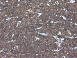 VBP1 Antibody in Immunohistochemistry (Paraffin) (IHC (P))