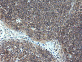 VBP1 Antibody in Immunohistochemistry (Paraffin) (IHC (P))