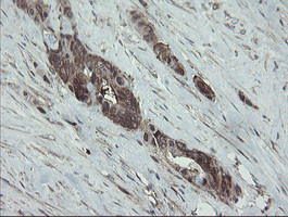 VBP1 Antibody in Immunohistochemistry (Paraffin) (IHC (P))