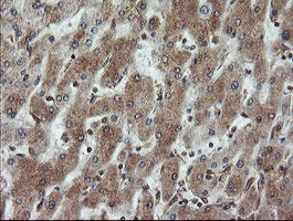 VBP1 Antibody in Immunohistochemistry (Paraffin) (IHC (P))