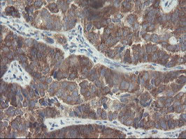 VBP1 Antibody in Immunohistochemistry (Paraffin) (IHC (P))