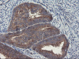 VBP1 Antibody in Immunohistochemistry (Paraffin) (IHC (P))