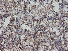 VBP1 Antibody in Immunohistochemistry (Paraffin) (IHC (P))