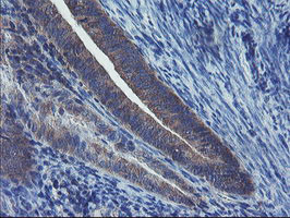 VBP1 Antibody in Immunohistochemistry (Paraffin) (IHC (P))