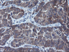 VBP1 Antibody in Immunohistochemistry (Paraffin) (IHC (P))