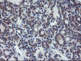 VBP1 Antibody in Immunohistochemistry (Paraffin) (IHC (P))