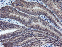 VBP1 Antibody in Immunohistochemistry (Paraffin) (IHC (P))