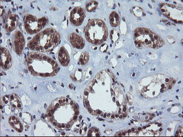 VBP1 Antibody in Immunohistochemistry (Paraffin) (IHC (P))