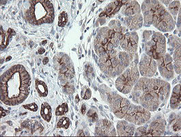 VBP1 Antibody in Immunohistochemistry (Paraffin) (IHC (P))