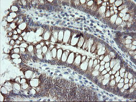 VBP1 Antibody in Immunohistochemistry (Paraffin) (IHC (P))