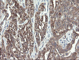 VBP1 Antibody in Immunohistochemistry (Paraffin) (IHC (P))