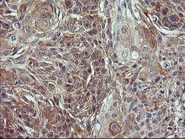 VBP1 Antibody in Immunohistochemistry (Paraffin) (IHC (P))