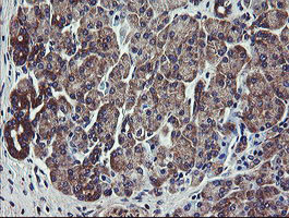 VBP1 Antibody in Immunohistochemistry (Paraffin) (IHC (P))