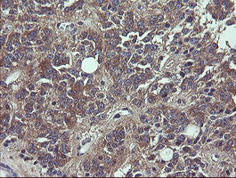 VBP1 Antibody in Immunohistochemistry (Paraffin) (IHC (P))