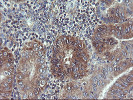 VBP1 Antibody in Immunohistochemistry (Paraffin) (IHC (P))