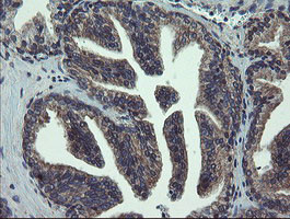 VBP1 Antibody in Immunohistochemistry (Paraffin) (IHC (P))