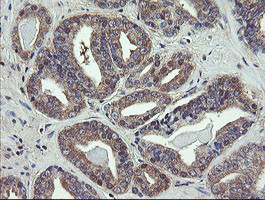 VBP1 Antibody in Immunohistochemistry (Paraffin) (IHC (P))