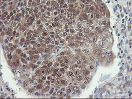 VBP1 Antibody in Immunohistochemistry (Paraffin) (IHC (P))