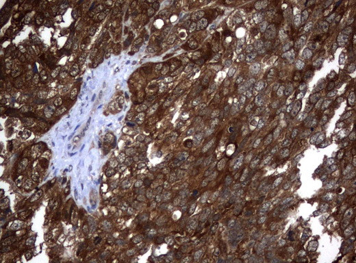 VBP1 Antibody in Immunohistochemistry (Paraffin) (IHC (P))