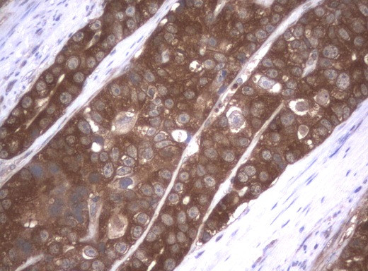 VBP1 Antibody in Immunohistochemistry (Paraffin) (IHC (P))