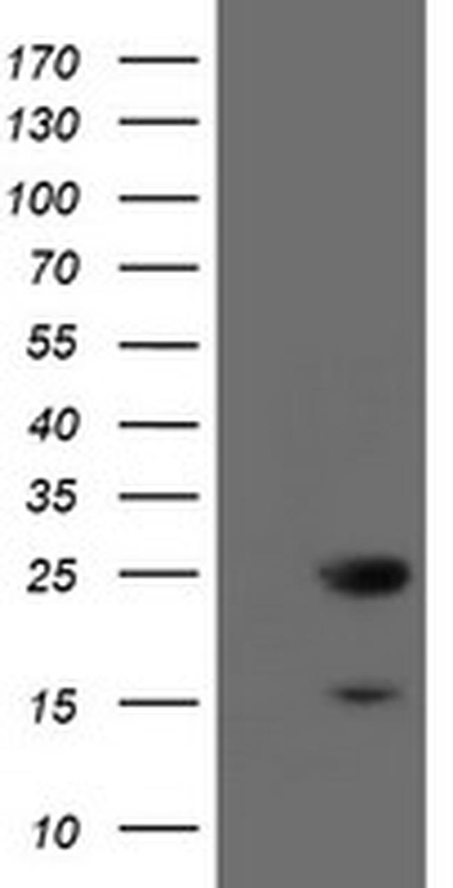 VBP1 Antibody in Western Blot (WB)