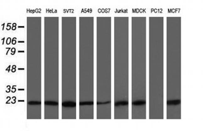 VBP1 Antibody in Western Blot (WB)