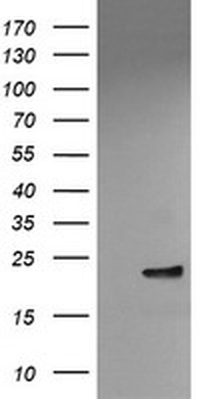 VBP1 Antibody in Western Blot (WB)