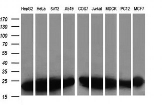 VBP1 Antibody in Western Blot (WB)