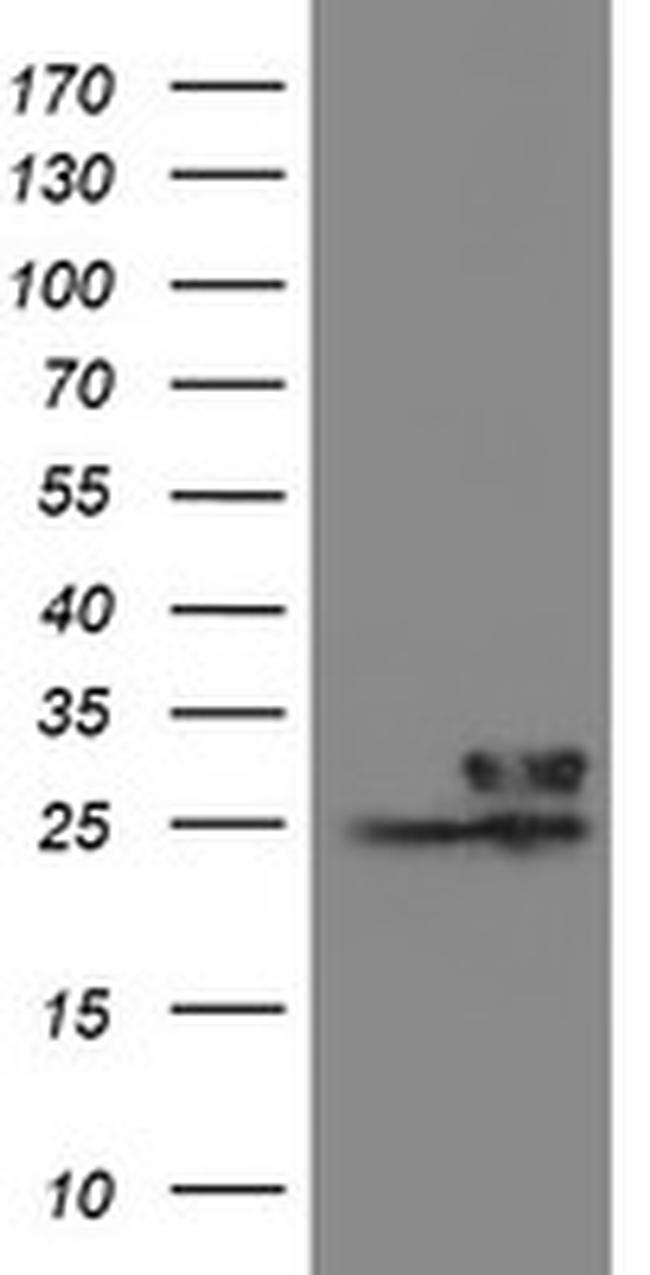 VBP1 Antibody in Western Blot (WB)