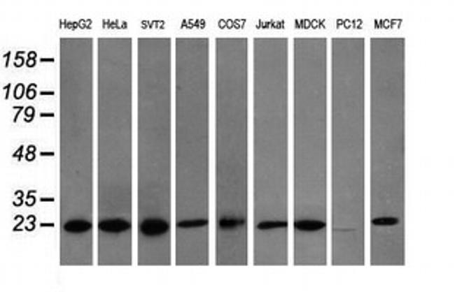 VBP1 Antibody in Western Blot (WB)